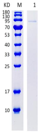 15% SDS-PAGE analysis profiles of purified VP1 (CBB stained).